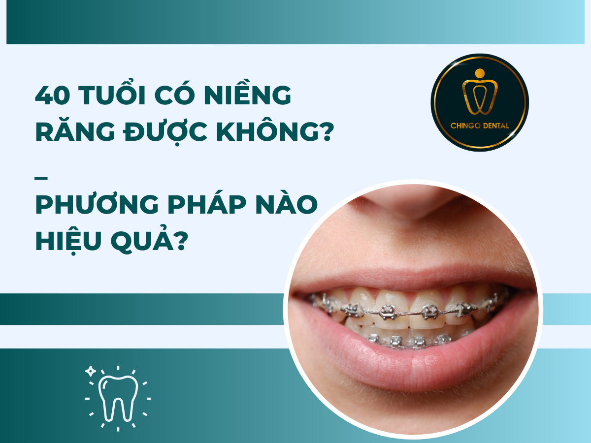 40 tuổi có niềng răng được không_ Phương pháp nào hiệu quả