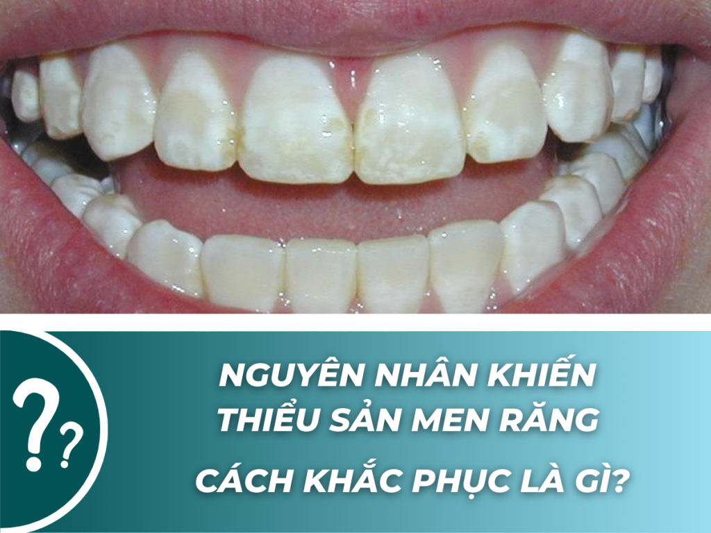 NGUYEN NHAN KHIEN THIEU SAN MEN RANG CACH KHAC PHUC LA GI