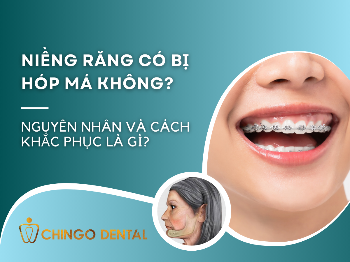 Niềng răng có bị hóp má không_ Nguyên nhân và cách khắc phục là gì