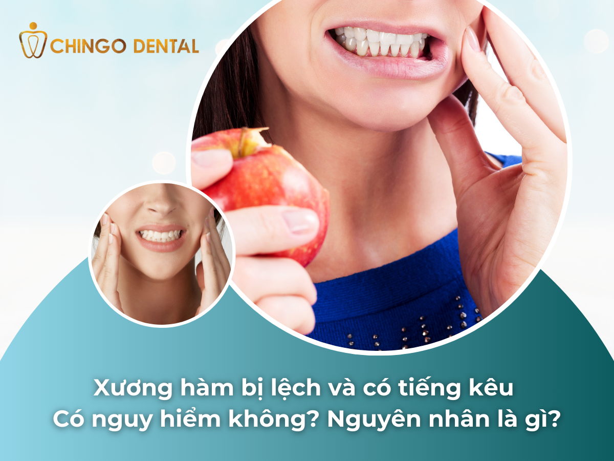 Xương hàm bị lệch và có tiếng kêu có nguy hiểm không Nguyên nhân là gì