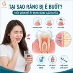 Cách Trị Ê Buốt Răng Tại Nhà: Giảm Tức Thì Và Khỏi Lâu Dài cách trị ê buốt răng tại nhà