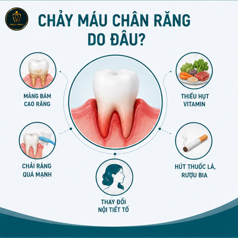 Chảy Máu Chân Răng: Nguyên Nhân, Dấu Hiệu Nguy Hiểm Và Khi Nào Cần Gặp Nha Sĩ 2 chảy máu chân răng do đâu