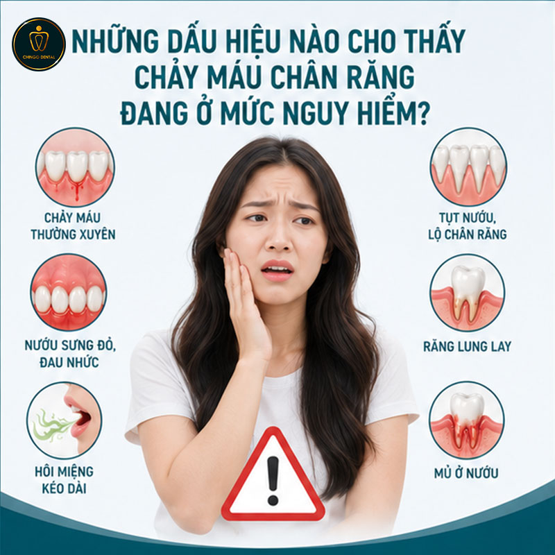 Chảy Máu Chân Răng: Nguyên Nhân, Dấu Hiệu Nguy Hiểm Và Khi Nào Cần Gặp Nha Sĩ 3 chảy máu răng