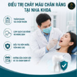Chảy Máu Chân Răng: Nguyên Nhân, Dấu Hiệu Nguy Hiểm Và Khi Nào Cần Gặp Nha Sĩ hay chảy máu chân răng là bệnh gì