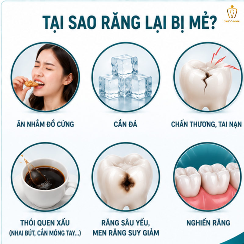 Răng Bị Mẻ: Nguyên Nhân, Nguy Hiểm Và Cách Phục Hồi Hiệu Quả Nhất 2 mẻ răng có sao không