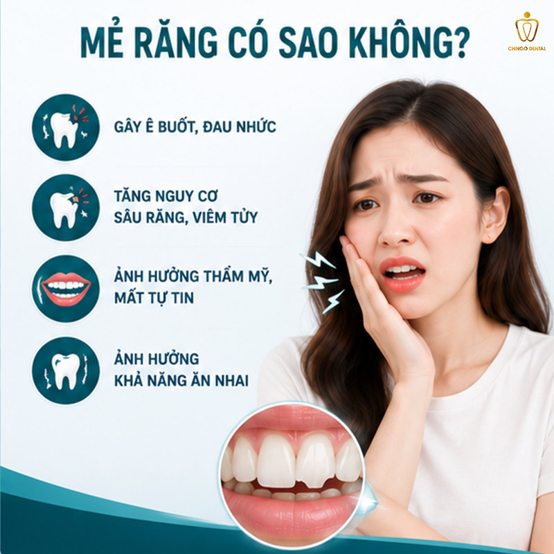 Răng Bị Mẻ: Nguyên Nhân, Nguy Hiểm Và Cách Phục Hồi Hiệu Quả Nhất 3 mẻ răng hàm có sao không