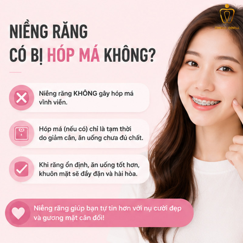 Niềng Răng Có Bị Hóp Má Không? Sự Thật Và Cách Phòng Tránh Hiệu Quả 1 niềng răng hóp má