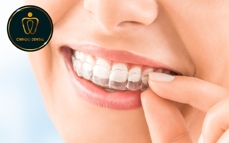 răng bọc sứ có niềng được không
