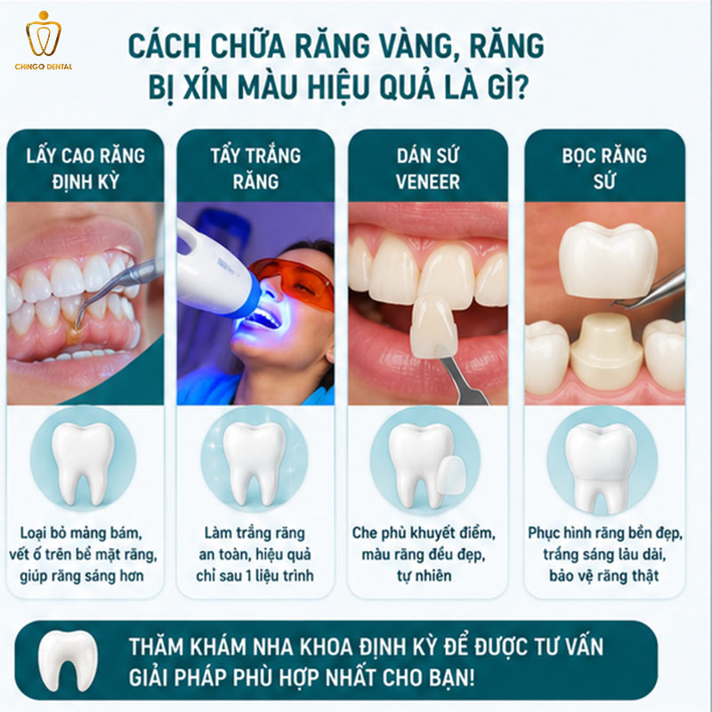 Răng Bị Xỉn Màu: Nguyên Nhân, Mức Độ Và Cách Khắc Phục Hiệu Quả 4 cách chữa răng vàng