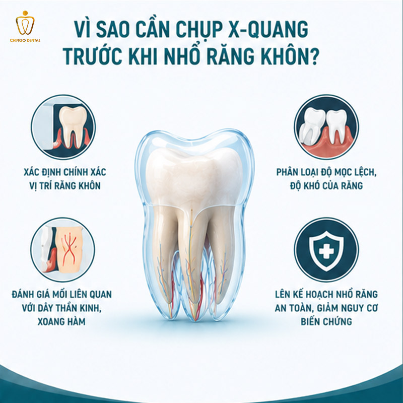 Chụp X-Quang Răng Khôn Bao Nhiêu Tiền? Khi Nào Cần Chụp? 2 chụp x quang răng