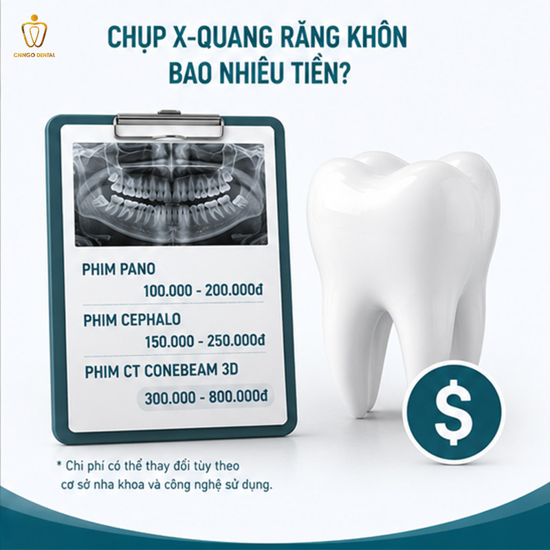 Chụp X-Quang Răng Khôn Bao Nhiêu Tiền? Khi Nào Cần Chụp? 4 chụp x quang răng hết bao nhiêu tiền