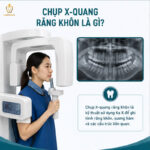 Chụp X-Quang Răng Khôn Bao Nhiêu Tiền? Khi Nào Cần Chụp? chụp x-quang răng khôn