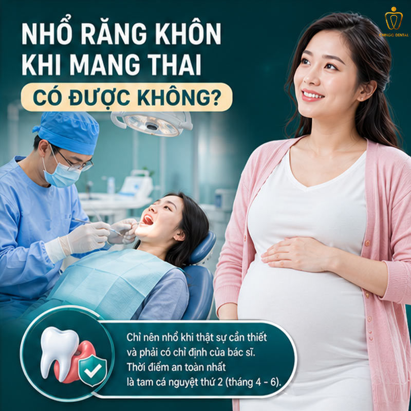 Nhổ Răng Khôn Khi Mang Thai Có An Toàn Không? Khi Nào Nên Và Khi Nào Không Nên? 2 có bầu nhổ răng được không