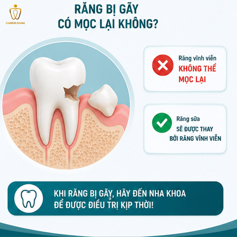 gãy răng
