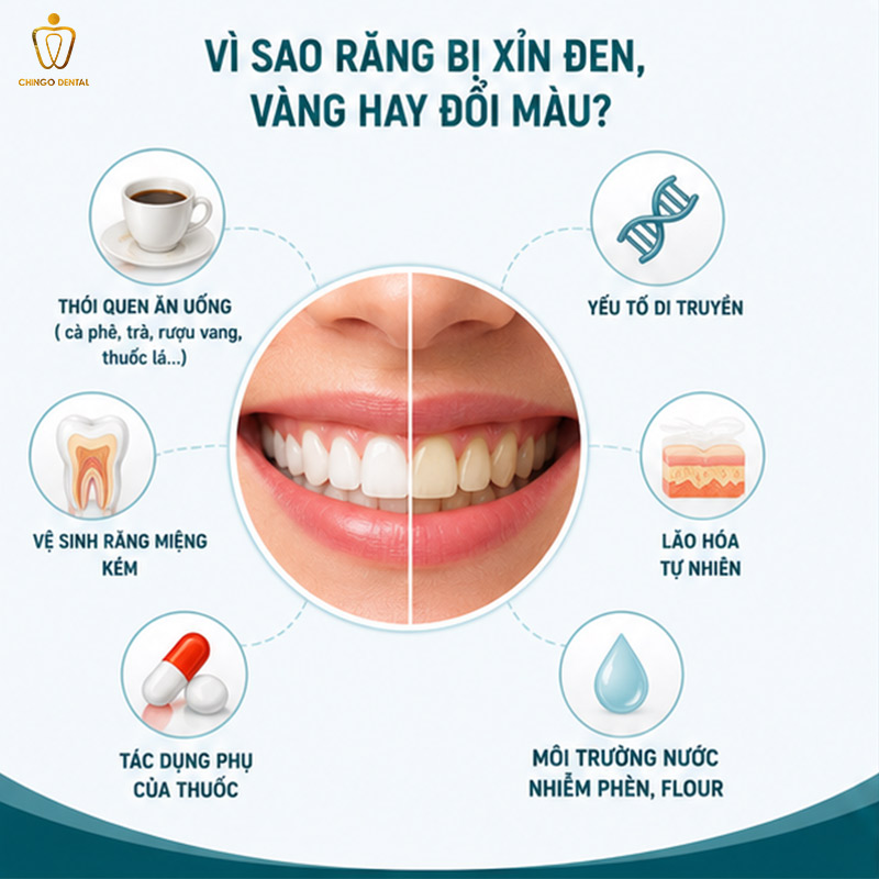 Răng Bị Xỉn Màu: Nguyên Nhân, Mức Độ Và Cách Khắc Phục Hiệu Quả 2 răng xỉn màu