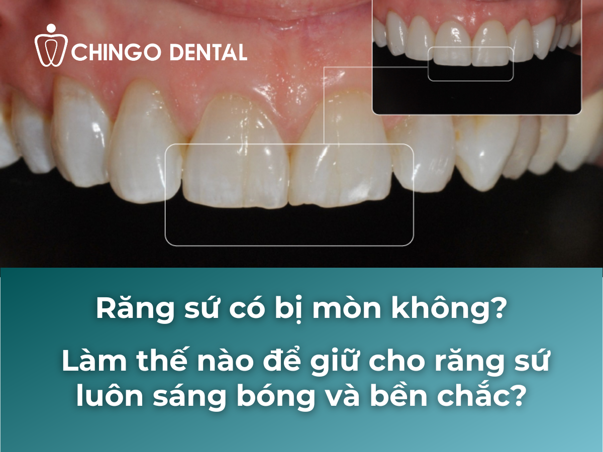 Răng Sứ Có Bị Mòn Không? Sự Thật Và Cách Bảo Vệ Hiệu Quả Lâu Dài 1