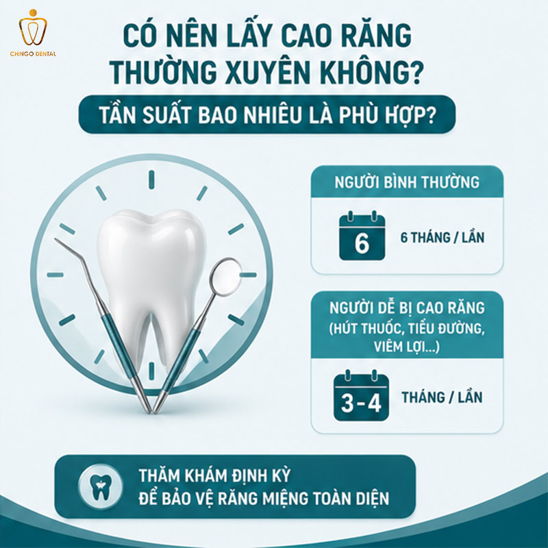 Có Nên Lấy Cao Răng Không? Giải Đáp Toàn Diện Từ Chuyên Gia Nha Khoa 4 cạo vôi răng có ảnh hưởng gì không