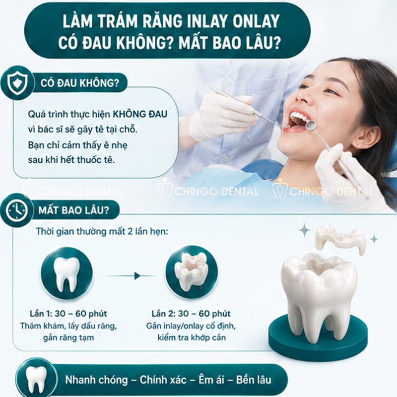 Trám Răng Inlay Onlay Là Gì? Giá Bao Nhiêu & Có Thực Sự Bền Hơn Trám Thường Không? 4 ceramic onlay
