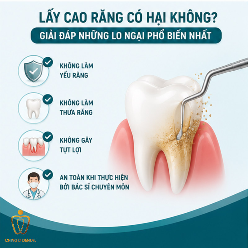Có Nên Lấy Cao Răng Không? Giải Đáp Toàn Diện Từ Chuyên Gia Nha Khoa 3 có nên lấy cao răng