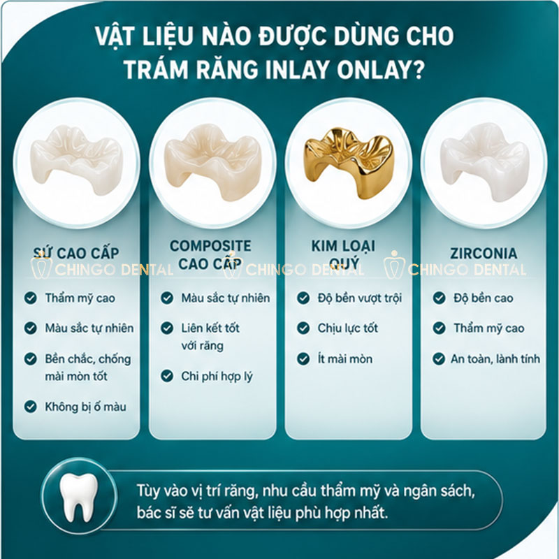 Trám Răng Inlay Onlay Là Gì? Giá Bao Nhiêu & Có Thực Sự Bền Hơn Trám Thường Không? 3 inlay onlay overlay