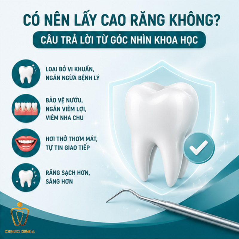 Có Nên Lấy Cao Răng Không? Giải Đáp Toàn Diện Từ Chuyên Gia Nha Khoa 23 lấy cao răng có tốt không