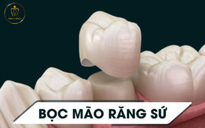 mao-rang-su-chingo-dental