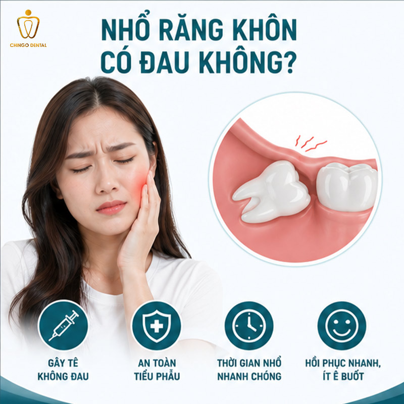 Nhổ Răng Khôn Có Đau Không? Sự Thật Về Mức Độ Đau Và Cách Giảm Đau Hiệu Quả 1 nhổ răng khôn có đau không