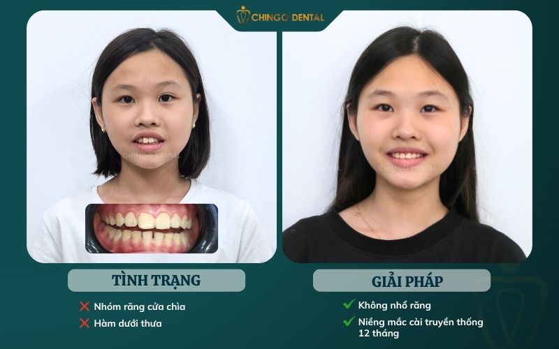 khách niềng hà nội