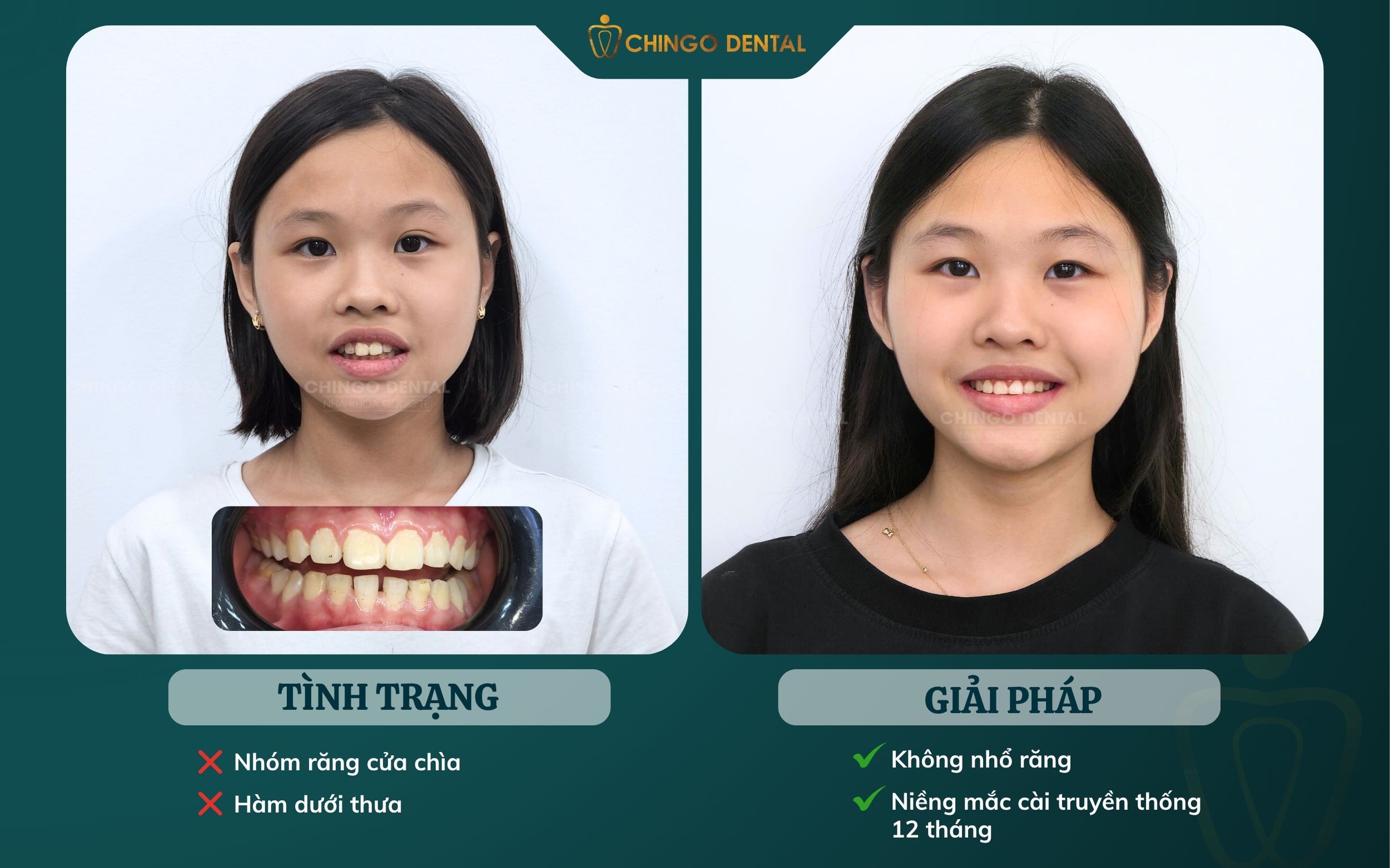 khách hàng niềng răng hà nội