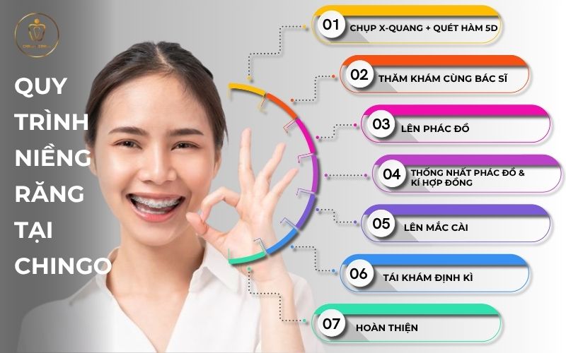 niềng răng ở Hà Nội