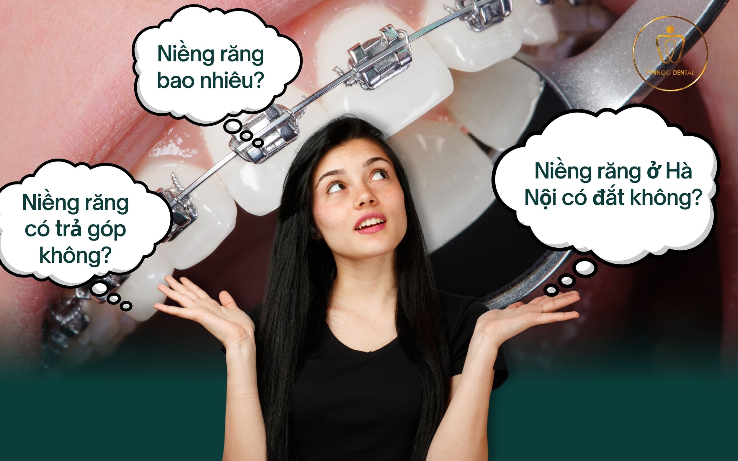 niềng răng hà nội giá