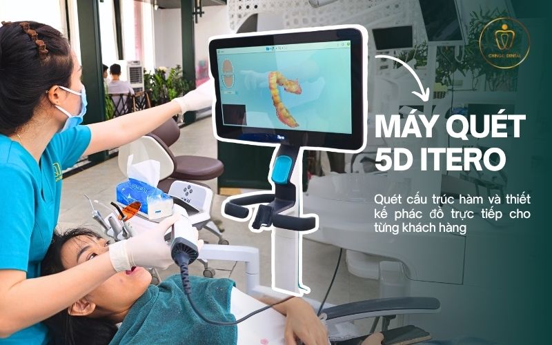 máy itero hà nội