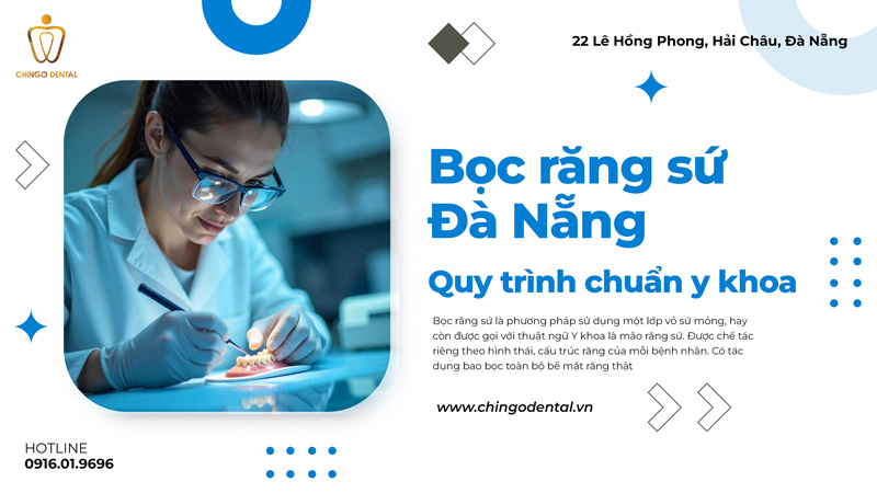 bọc răng sứ ở đà nẵng