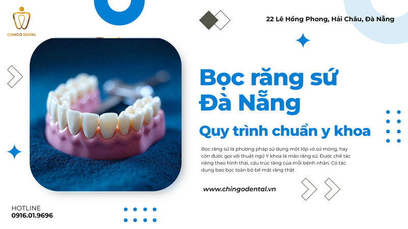 bọc răng sứ uy tín tại đà nẵng