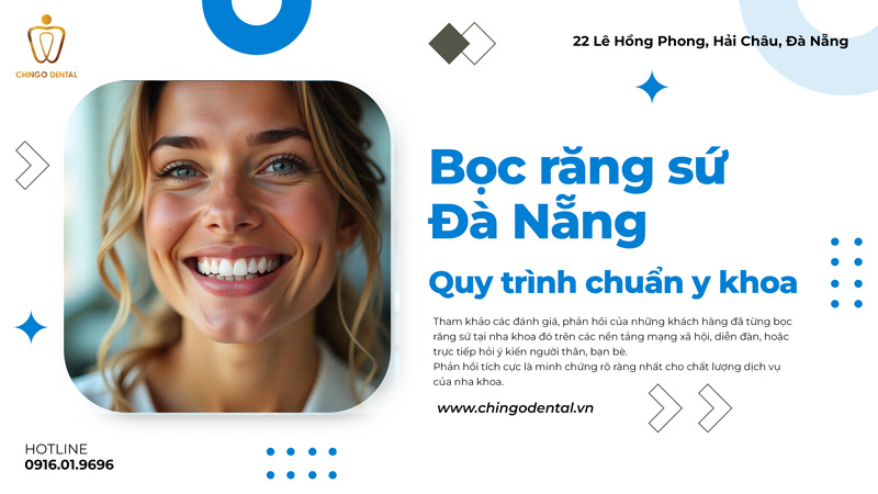 bọc răng sứ uy tín