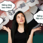 Giá Niềng Răng Hà Nội Bao Nhiêu - Gợi Ý Địa Chỉ Trả Góp "Chi Phí Mềm" Nhất Thủ Đô giá niềng răng Hà Nội