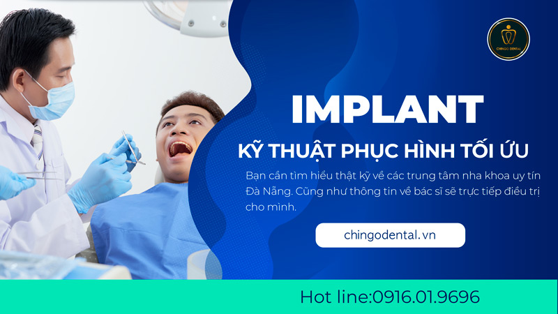 làm răng sứ tại đà nẵng