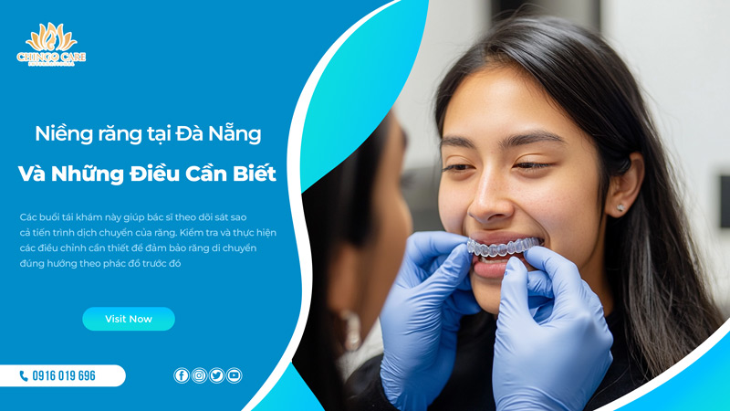 niềng răng Đà Nẵng