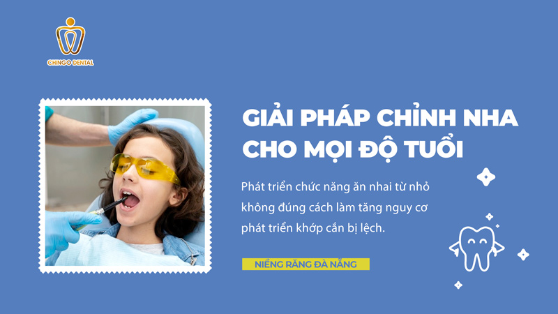 Niềng Răng Đà Nẵng: Lựa Chọn Tuyệt Vời Để Sở Hữu Nụ Cười Chuẩn Đẹp 1 nieng-rang-tai-da-nang
