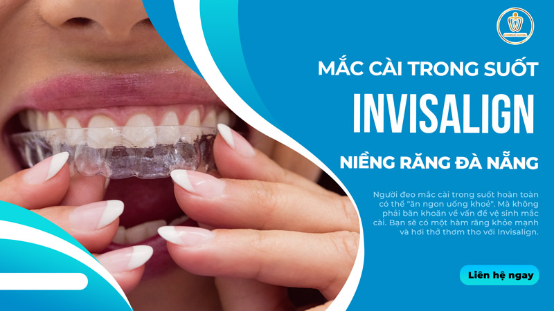niềng răng trong suốt Đà Nẵng