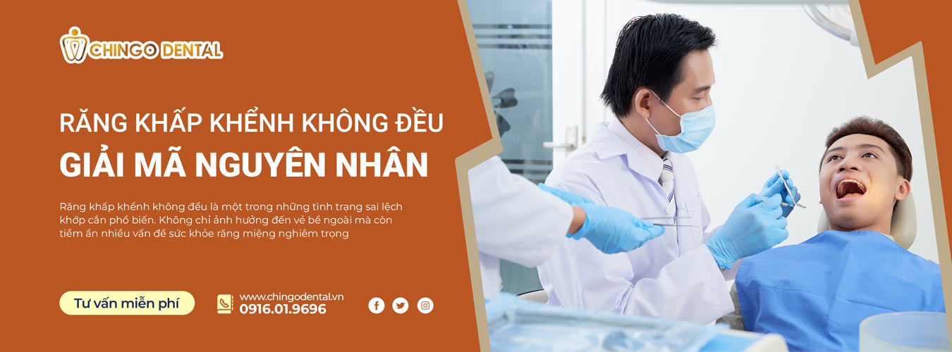 răng khấp khểnh không đều 