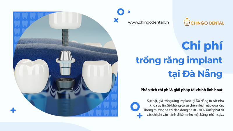 trồng răng implant đà nẵng