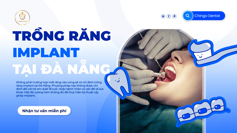 trồng răng implant đà nẵng
