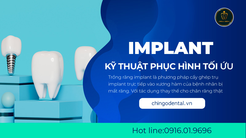 trồng răng implant đà nẵng