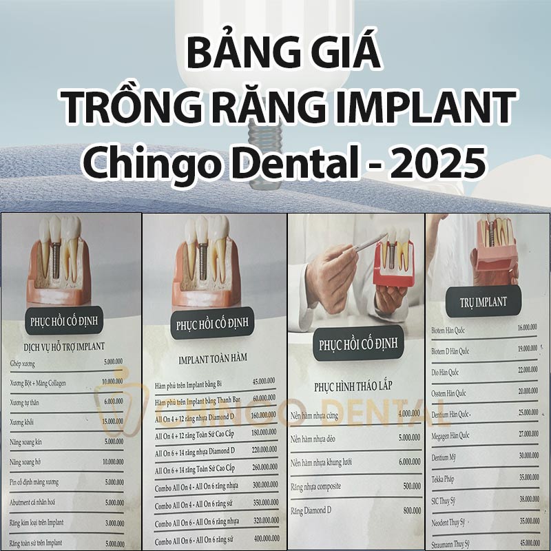 trồng răng implant tại đà nẵng