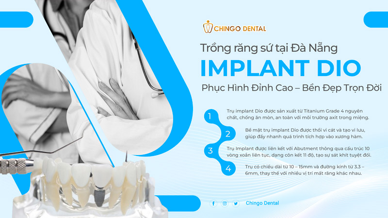 giá trồng răng implant tại đà nẵng