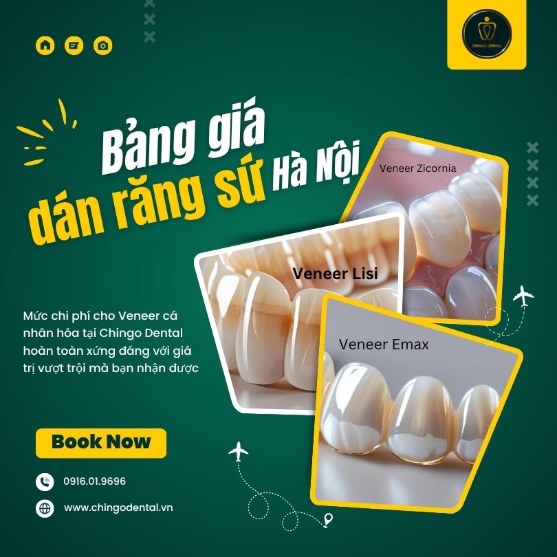 bảng giá dán răng sứ Hà Nội