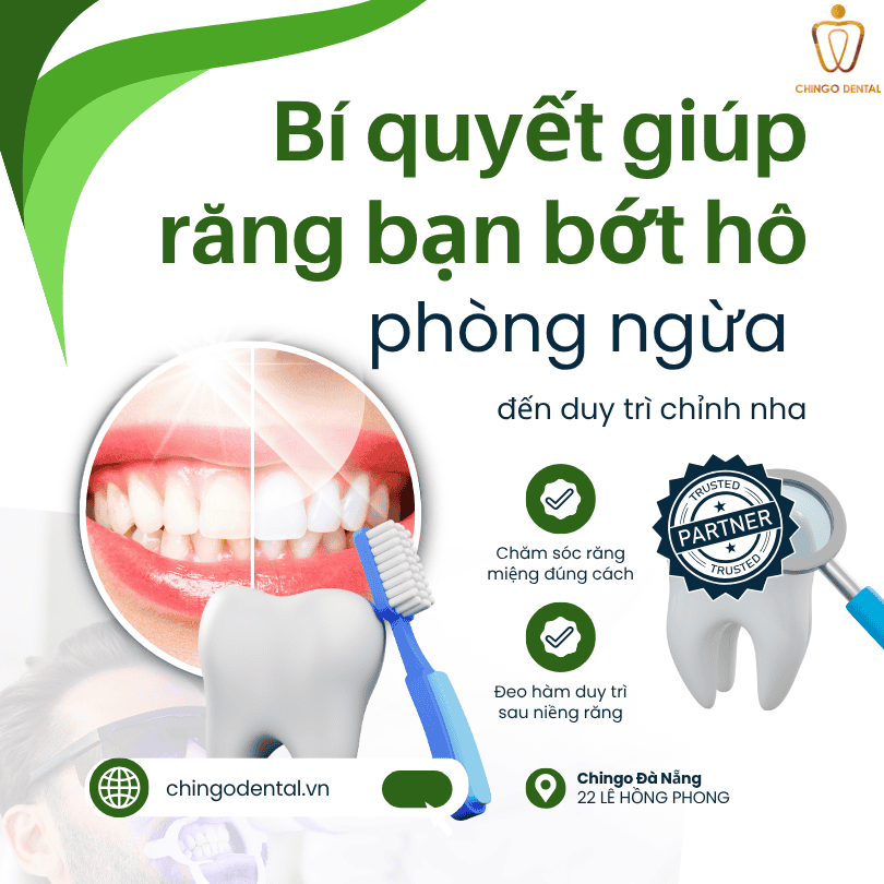 Bí quyết giúp răng bớt hô