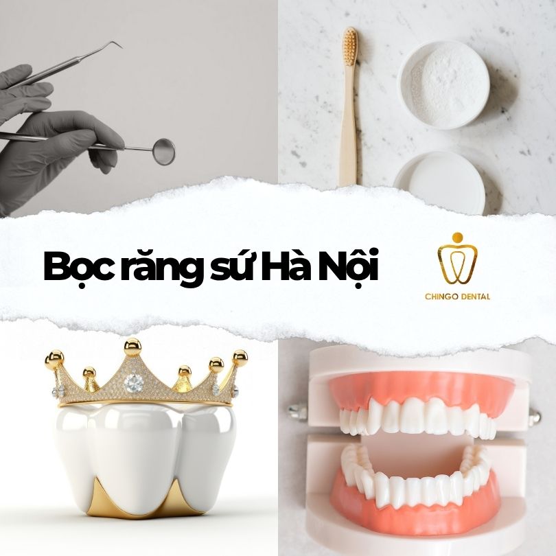 bọc răng sứ hà nội