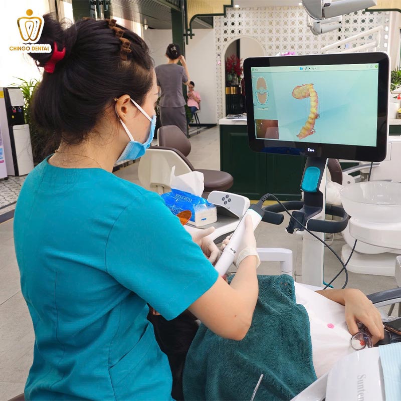 bọc răng sứ tại hà nội